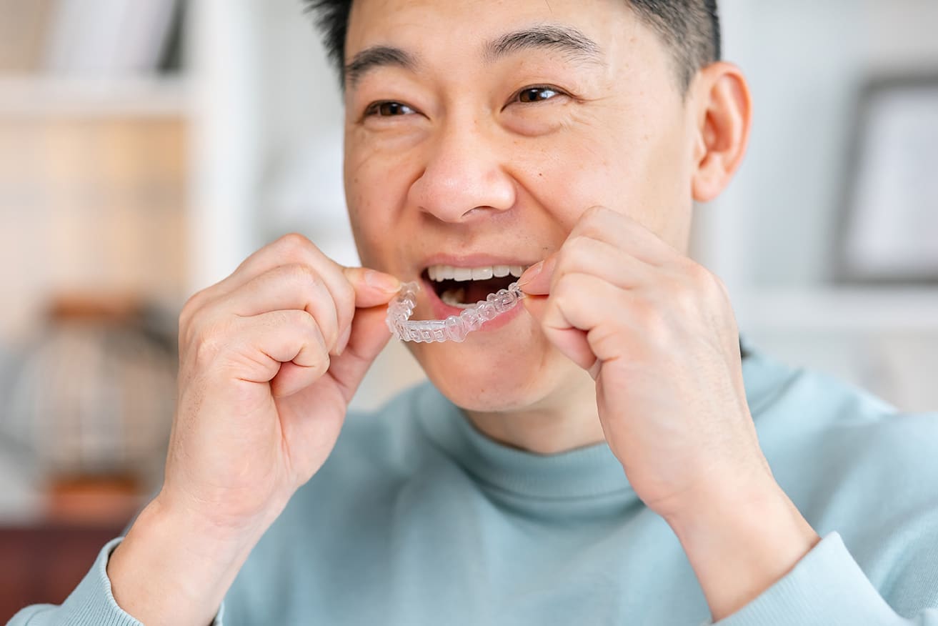 man placing invisalign in his mouth from o'shee family dentistry