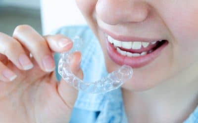 Invisalign in Baton Rouge: Straighten Your Teeth Discreetly
