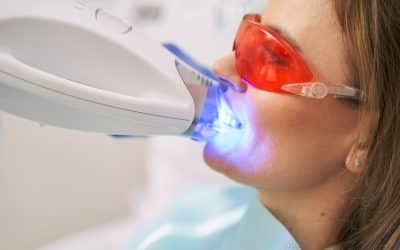 Teeth Whitening in Baton Rouge: In-Office vs. At-Home Kits