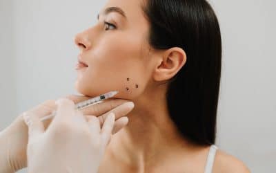 Botox at the Dentist? How Cosmetic Injections Enhance Your Smile in Baton Rouge