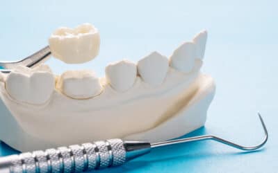 When Is a Dental Crown Necessary?